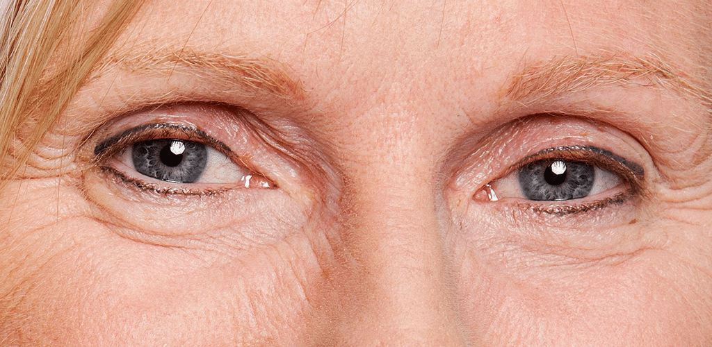 Dit is een afbeelding van voor een behandeling van ogen, de wenkbrauwen hebben nog geen permanente make-up, door Permanent Mooi
