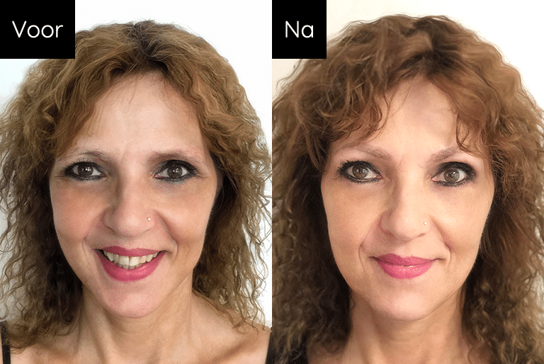Dit is beeld van Iris voor en na behandeling permanente make-up wenkbrauwen - Janny Hanegraaf heeft dit gemaakt