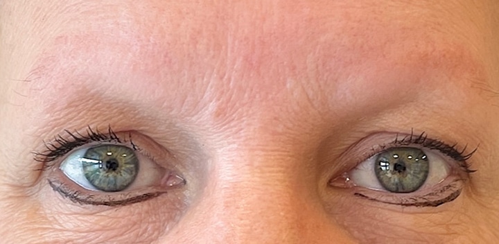 Dit is een afbeelding van voor een behandeling van ogen, de wenkbrauwen hebben nog geen permanente make-up, door Permanent Mooi