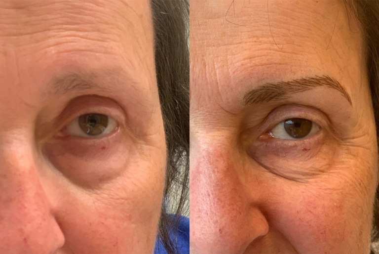 Dit is een afbeelding van voor en na een behandeling van ogen, de wenkbrauwen hebben uiteindelijk permanente make-up, door Permanent Mooi