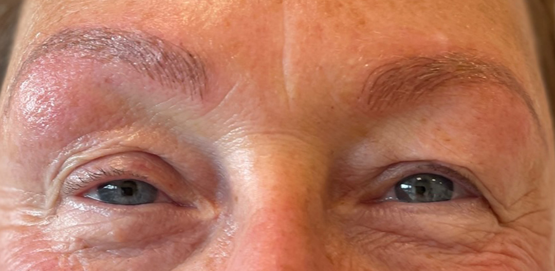 Na behandeling Permanente Make Up