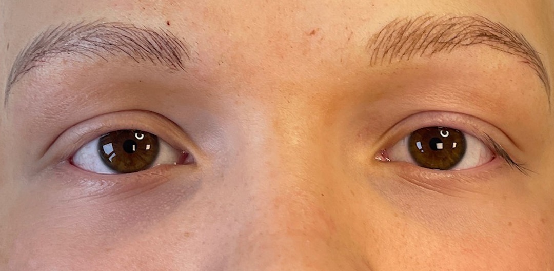 Dit is een beeld van ogen van een jongen na behandeling wenkbrauwen permanente make-up Alopecia Behandeling